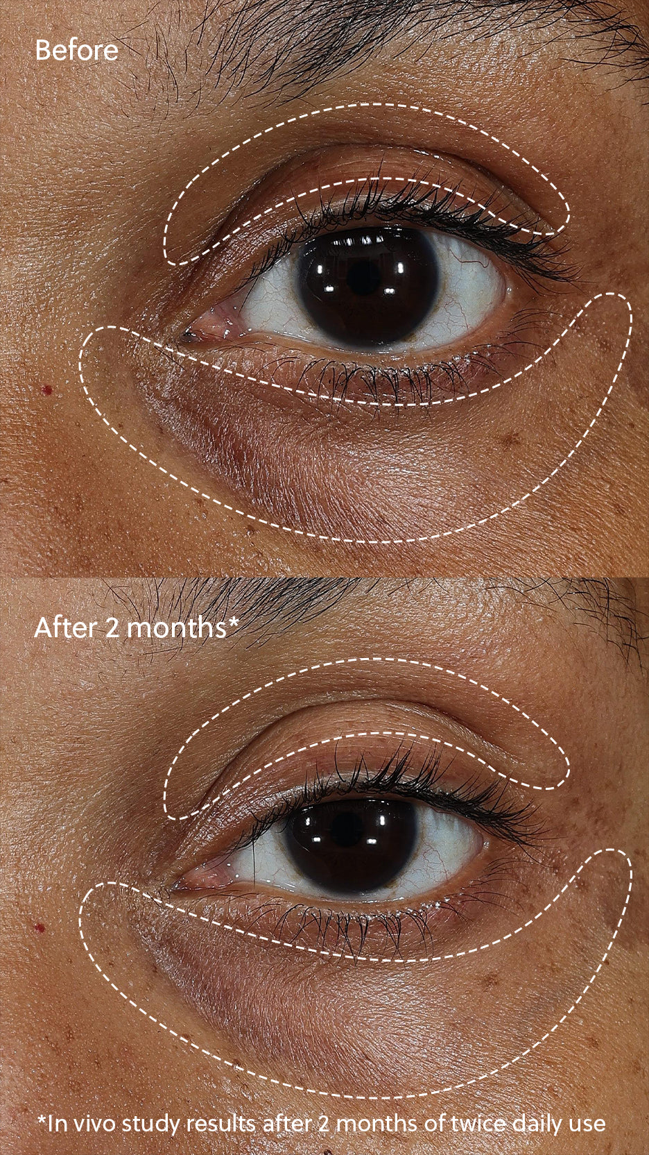 Eminence Organics: Vitamin C+ Eye Cream